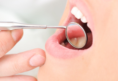 prevent tooth loss in Irvine, CA 92618